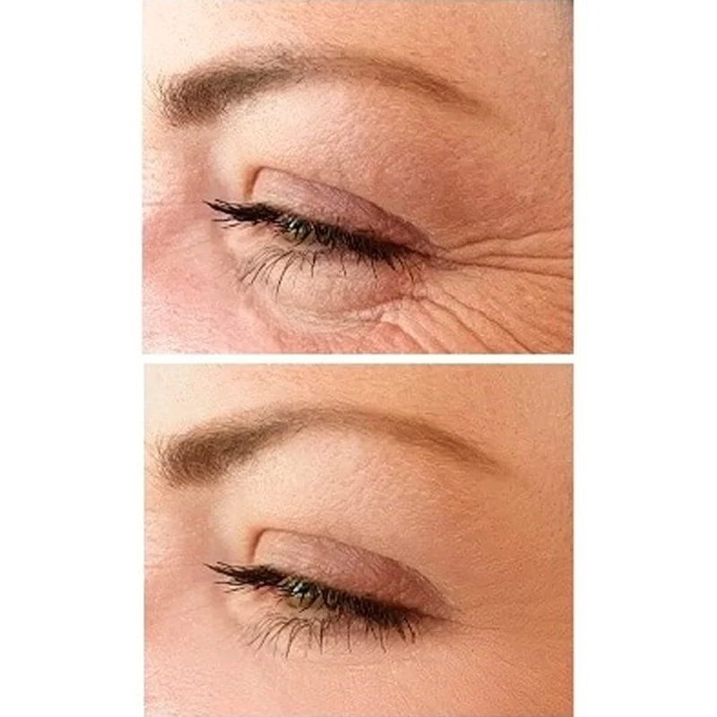 Crema de Ojos Lifting No.1 15 ml