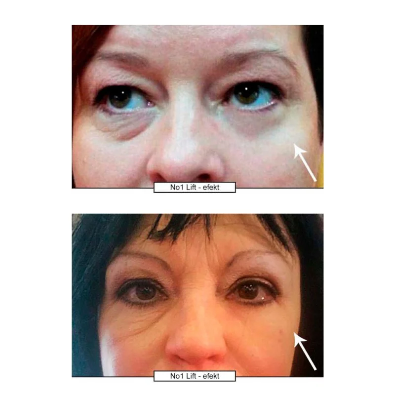 Crema de Ojos Lifting No.1 15 ml