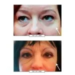Crema de Ojos Lifting No.1 15 ml