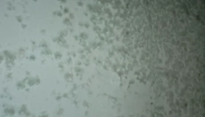 Métodos efectivos para combatir el moho en la pared