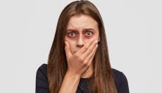 Cómo tratar los moretones con métodos naturales comprobados